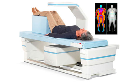 Ostéodensitomètre DXA scanner- santé osseuse- Horizon W/Wi- Hologic