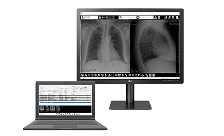 Console diagnostic radiographie- logiciel imagerie médicale- Med Diag