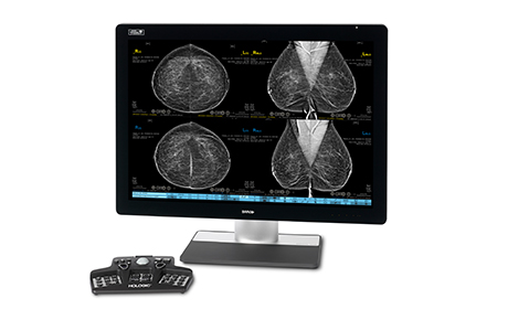Console diagnostic mammographie- logiciel imagerie médicale- SecurView