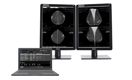 Console diagnostic mammographie- logiciel imagerie médicale- Med Mammo